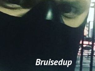 Bruisedup